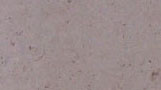 Limestone Dune